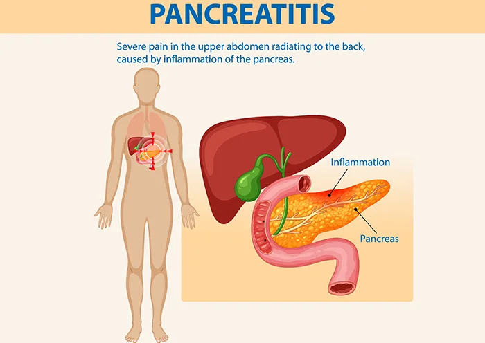 Gastrointestinal Surgery