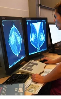 mammography