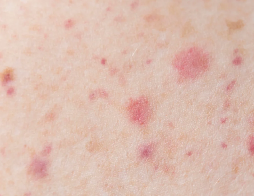 Ailments Image