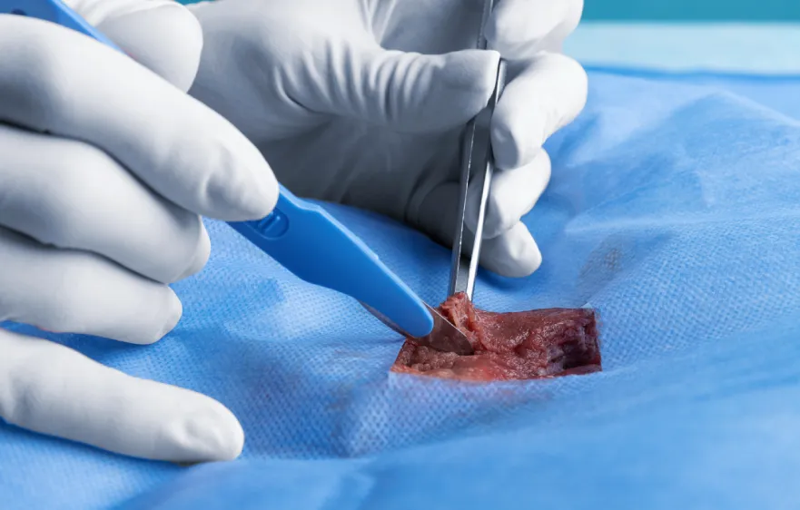 Debridement