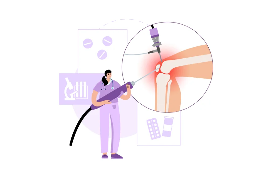 Arthroscopy 