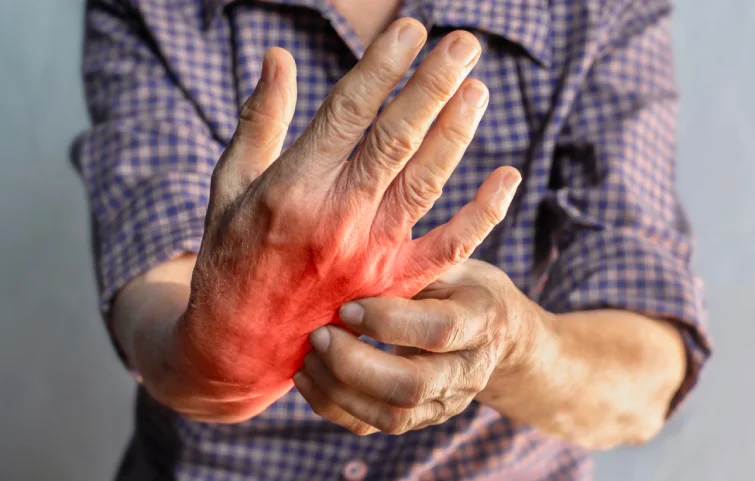 rheumatoid-arthritis.webp