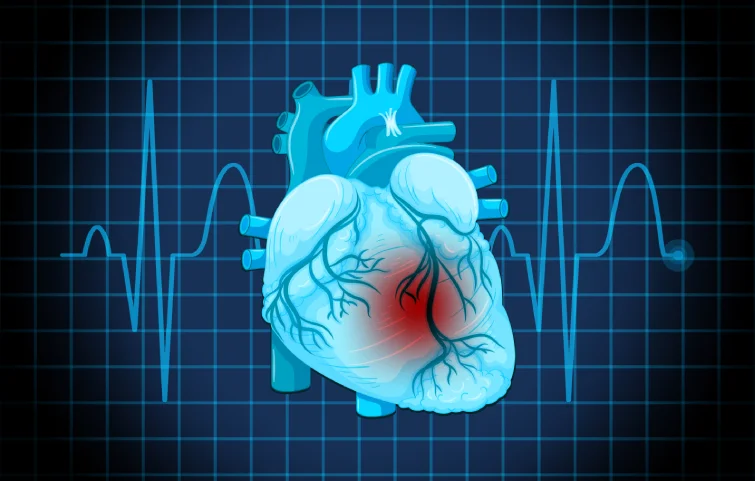 arrhythmia-banner.webp