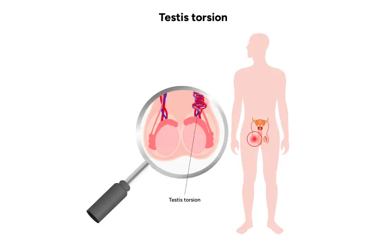 testicular-banner2.webp