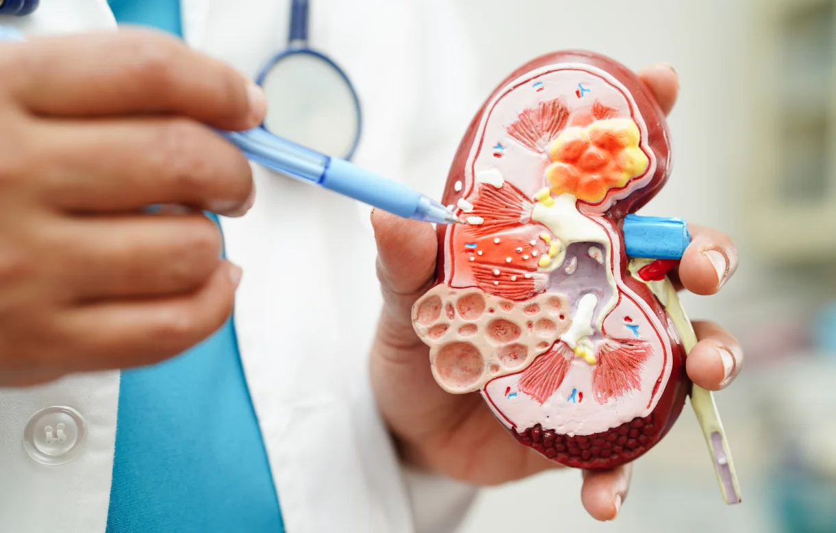 12asi_nephrotic1.webp