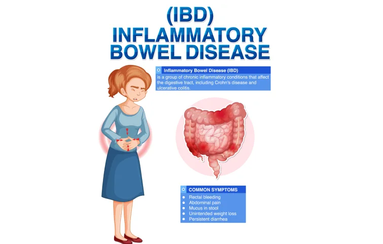 179asi_inflammatory1.webp