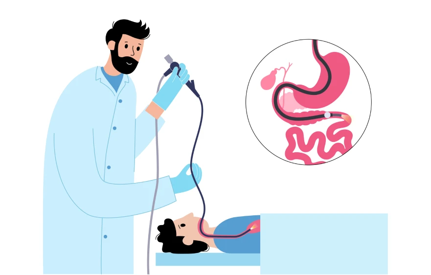 ugi-endoscopy.webp