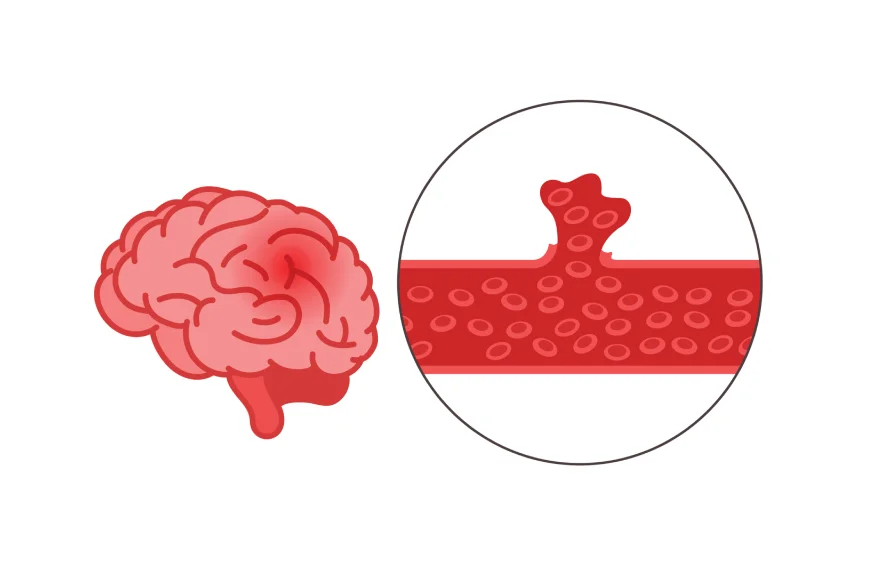 brain-hammriage-banner.webp