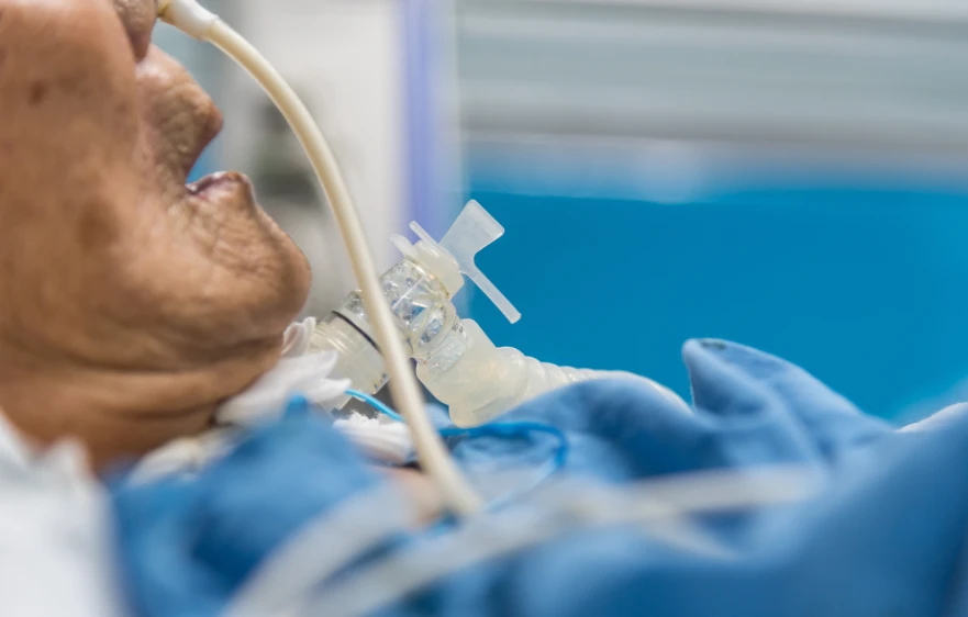 overview-tracheostomy.webp