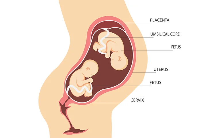 twin-pregnancy-banner2.webp