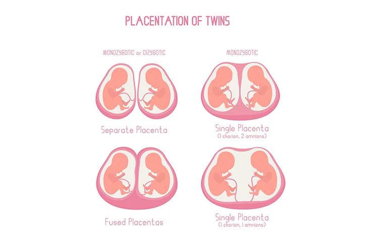 twin-pregnancy-banner3.webp