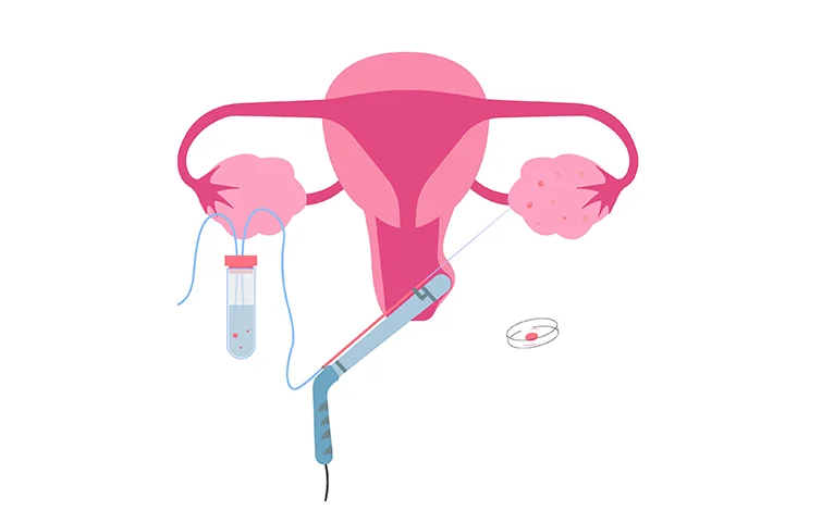 infertility-banner2.webp