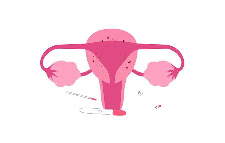 infertility-banners.webp