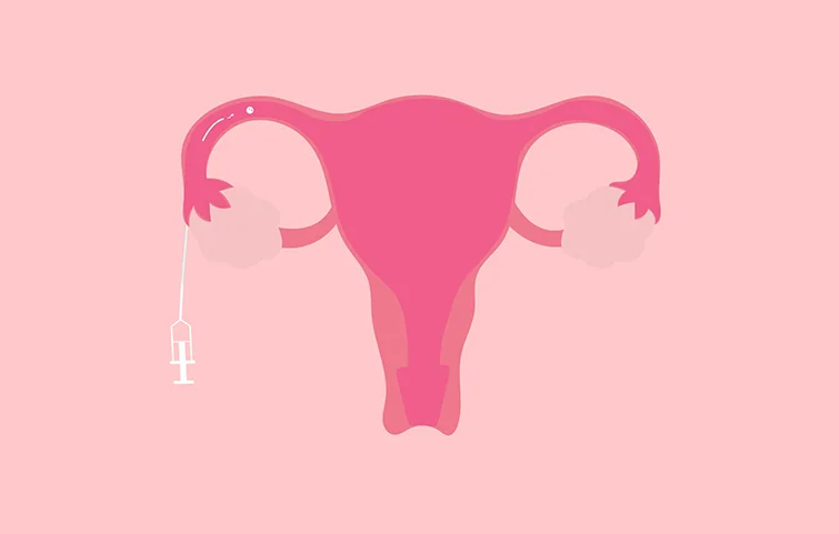 infertility-banners5.webp
