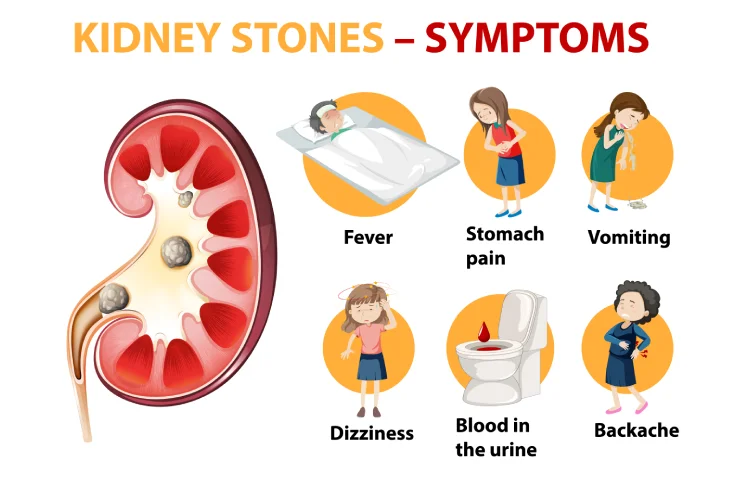 3asi_kidney1.webp