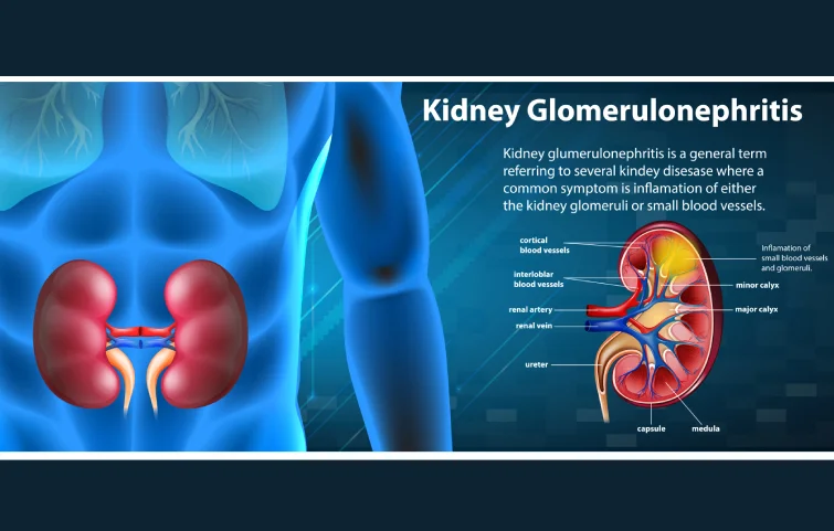 accute-kidney-injury-banner5.webp