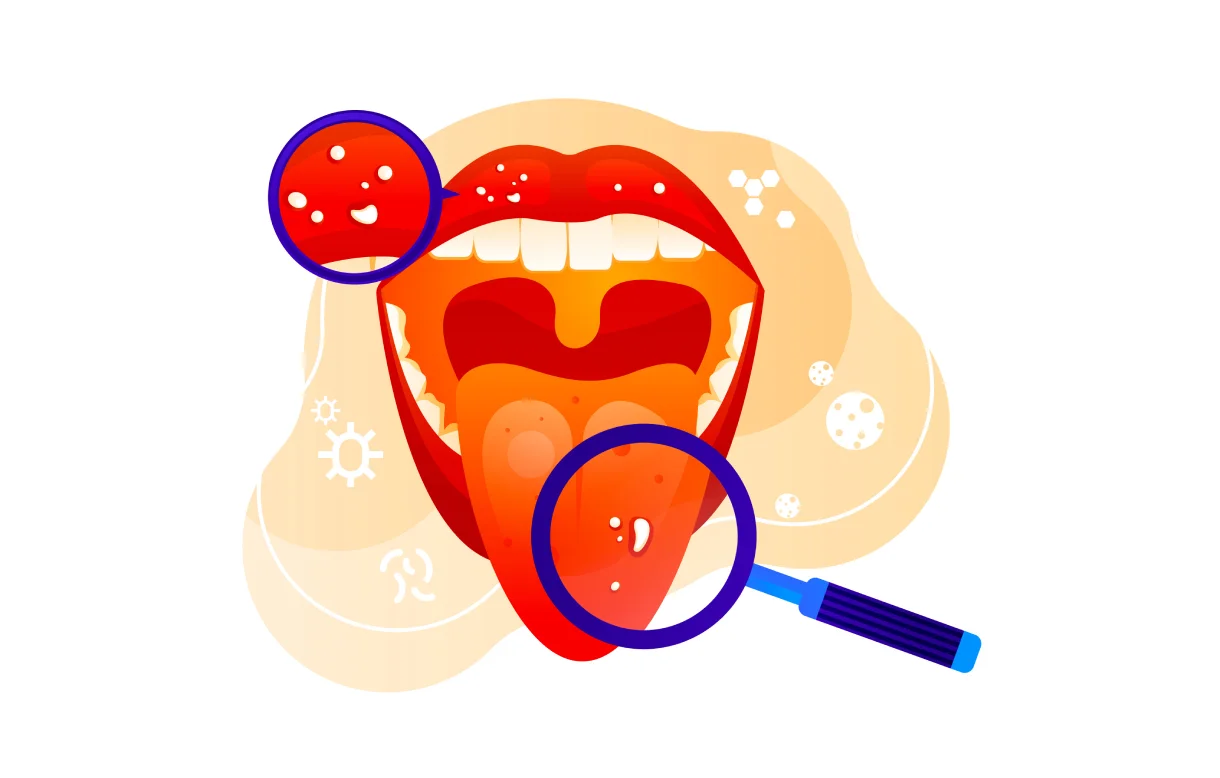 72asi_oralcancer1.webp