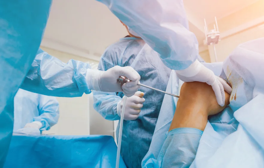85procs_arthroscopy-banner(1).webp