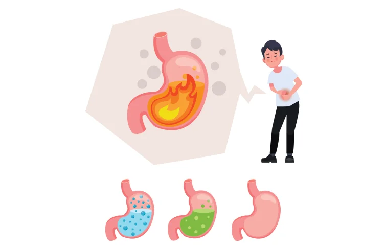 peptic-ulcer-banner4.webp