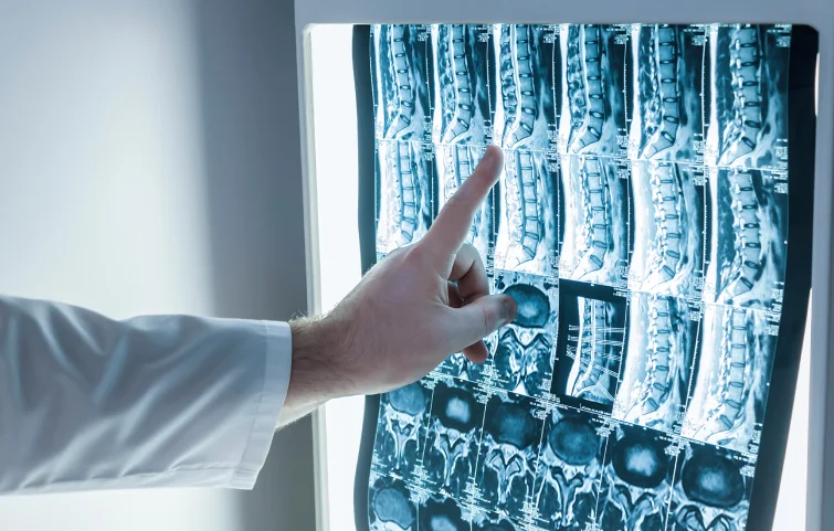 spinal-tumor-banner.webp