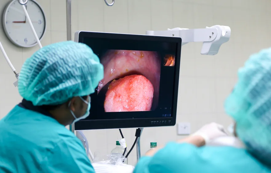 colonoscopy-banner.webp